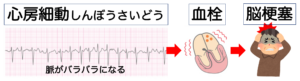 心房細動は脳梗塞になりやすい？
