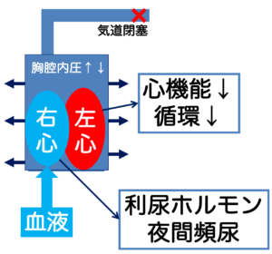 睡眠時無呼吸症候群によって心臓に負担がかかる仕組みとは？
