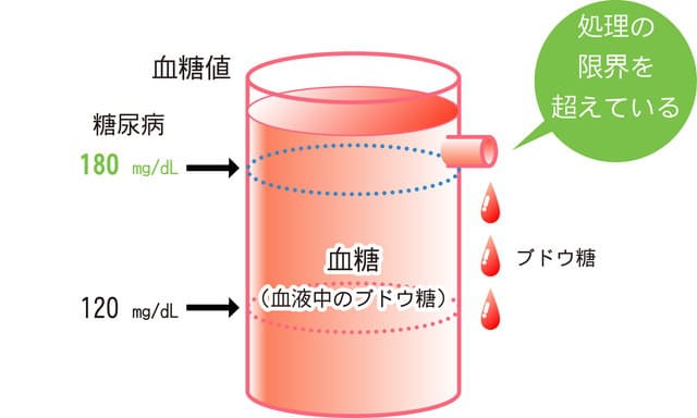 尿に糖がもれる