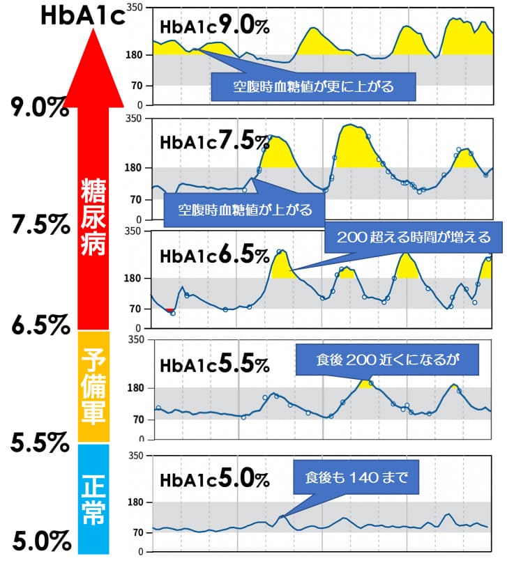 ヘモグロビンA1cと血糖値の動き