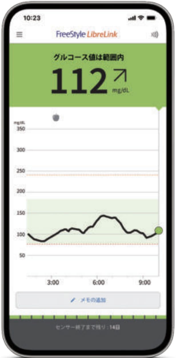 スマホで血糖値が見える