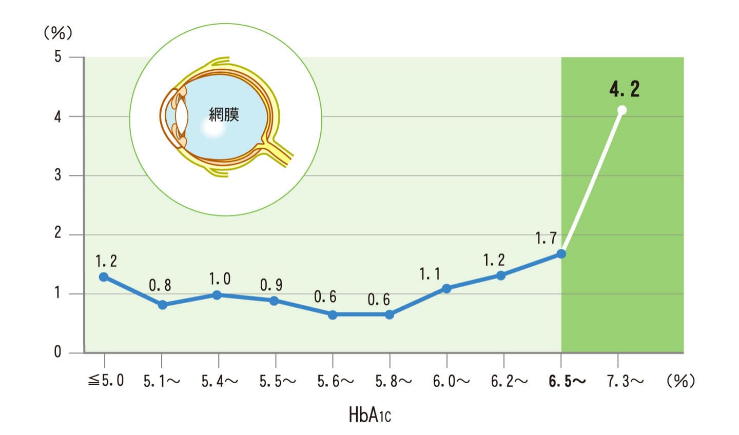 糖尿病網膜症