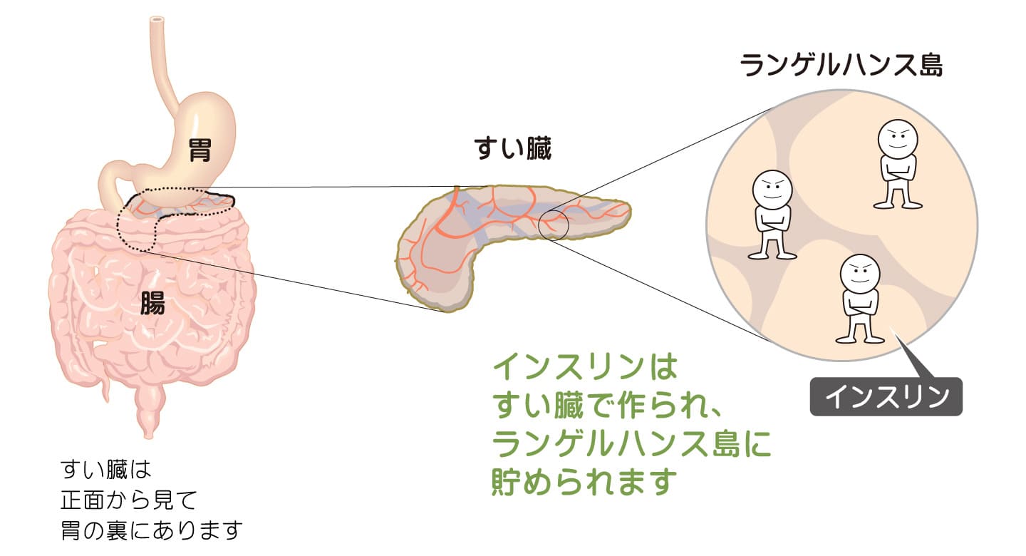 インスリンホルモンはすい臓で作られる。