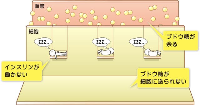 インスリンが働かない。
