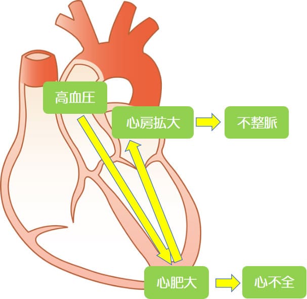 心肥大