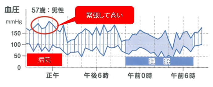 24時間の血圧