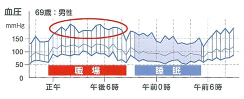 24時間の血圧