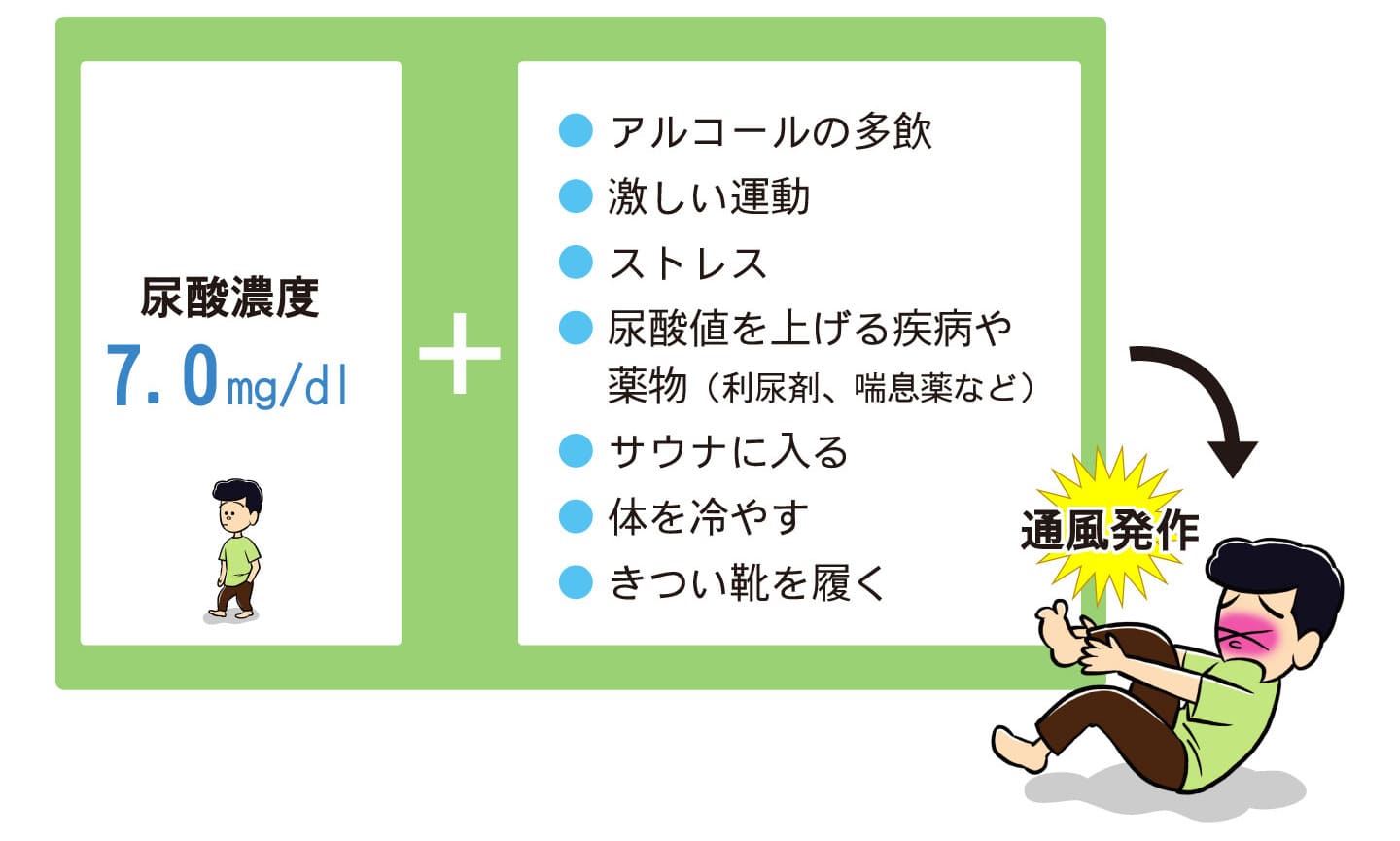 痛風発作の誘因は？