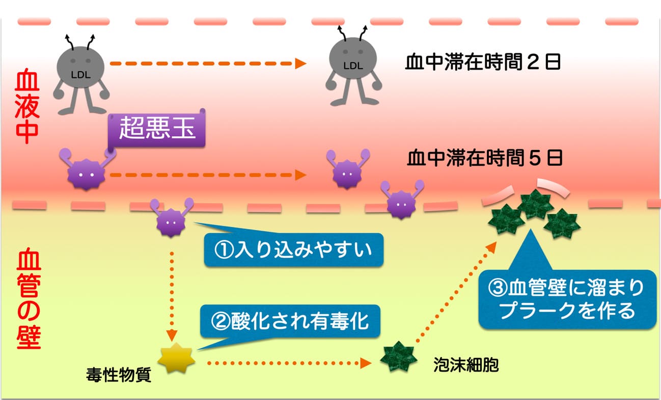 超悪玉コレステロールが動脈硬化を起こす