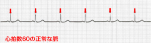 心拍数60の正常な脈