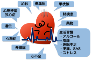 不整脈の原因