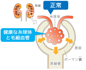 正常な腎臓