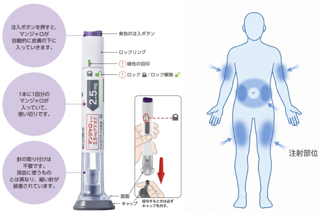 マンジャロの図説、使い方、体の注射部位の画像、神戸市灘区 肥満治療 おおや内科