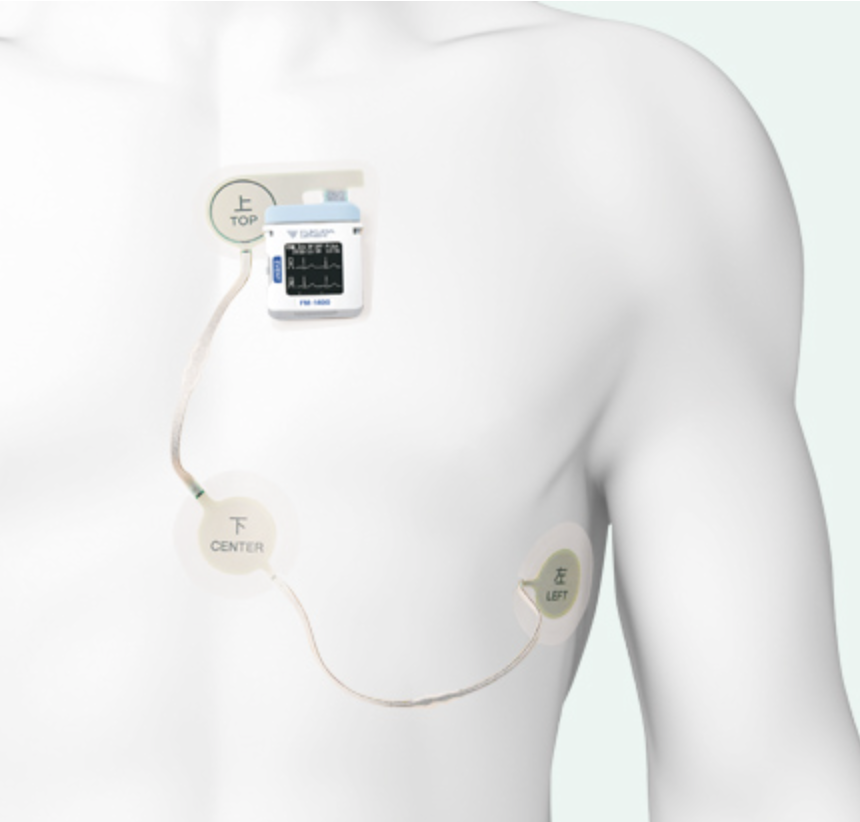 ホルター心電図